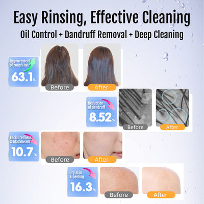 Ultra Fine Bubble Generator with 0.1-50 Microns Bubble Size for 300% Pesticide Residue Removal and 100 Million Bubbles/ml Deep Pore Cleansing